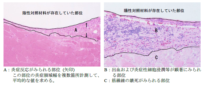 筋肉内埋植試験：陰性および陽性対照材料をウサギの背部筋肉内に1週間埋植した炎症部位の組織