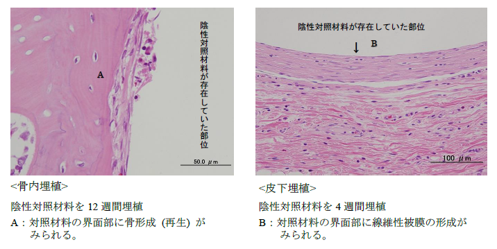 骨内・皮下埋植試験：ウサギの大腿骨内および皮下に陰性対照材料を埋植した組織