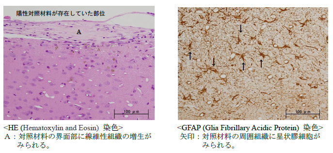 脳内埋植試験：ウサギの脳内に陽性対照材料を1週間埋植した組織