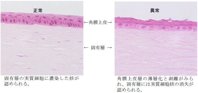 眼装用試験：コンタクトレンズ装用試験における角膜組織