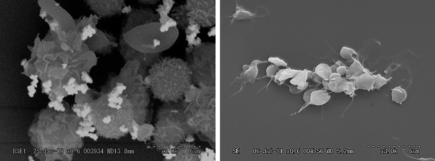 左図 > 免疫電検像（ラット単球）　右図 > 血液適合性試験（血栓性）：医療材料表面の走査電子顕微鏡像（血小板の粘着）