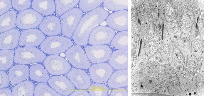 左図 > 病理学的検査：ラット精巣（トルイジンブルー染色標本） 右図 > 病理学的検査：ラット精巣（透過電子顕微鏡像）