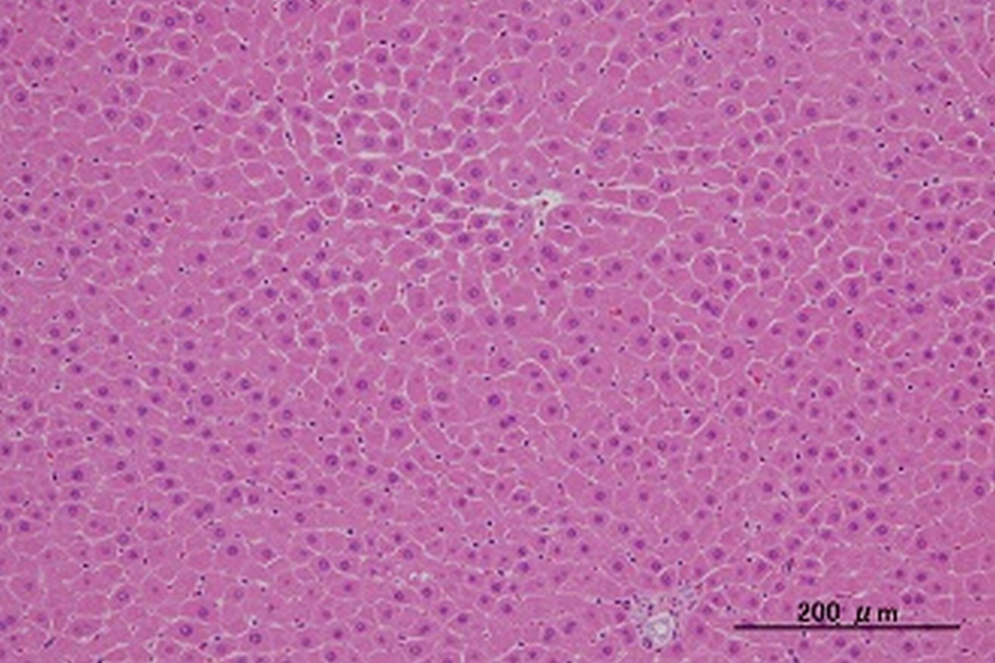 全身毒性試験の目的：病理学的検査での肝臓のHE染色写真